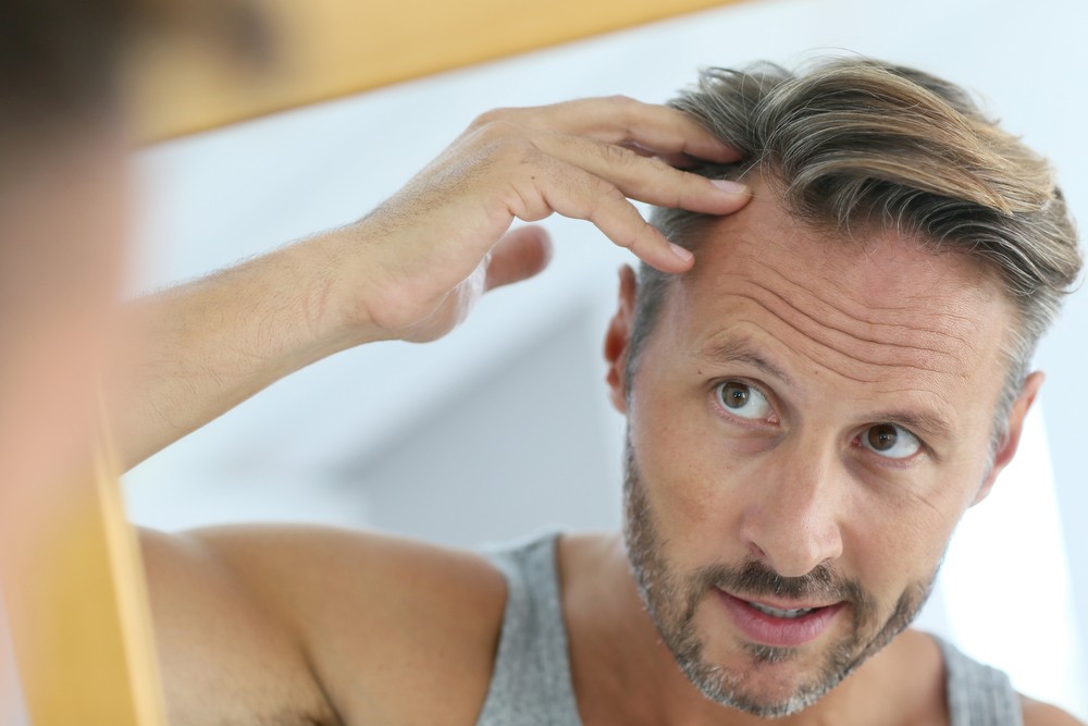 Man inspects effects of diabetic hair loss -- Diabetes and Hair Loss