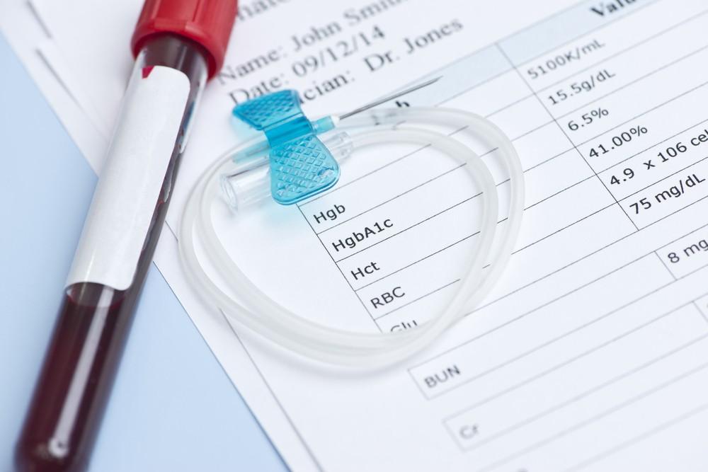 Elderly A1C Targets: Should Older People Have More Relaxed Glucose Goals?