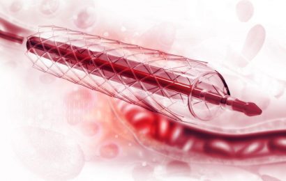 Cardiac Stent