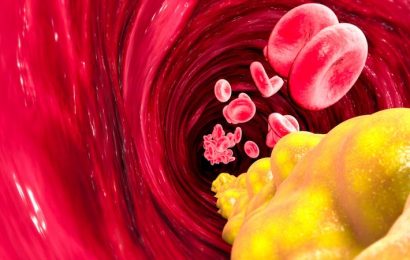 Statin Alternatives: Other Medications That Can Lower Cholesterol