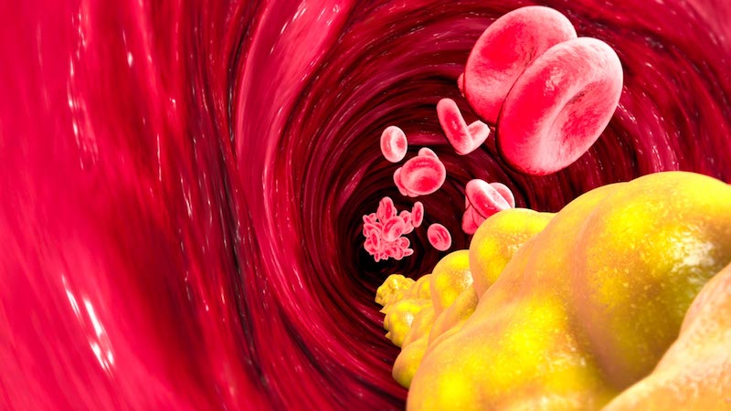 Your Cholesterol Questions Answered