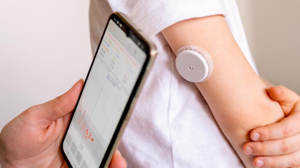 Continuous Glucose Monitoring, Insulin Pump Best for Glucose Control in Youth With Type 1 Diabetes